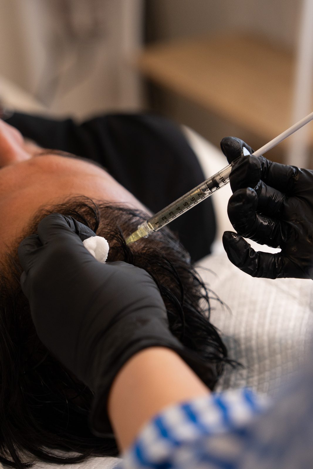 Growth factor treatment application at Kaiz Auckland