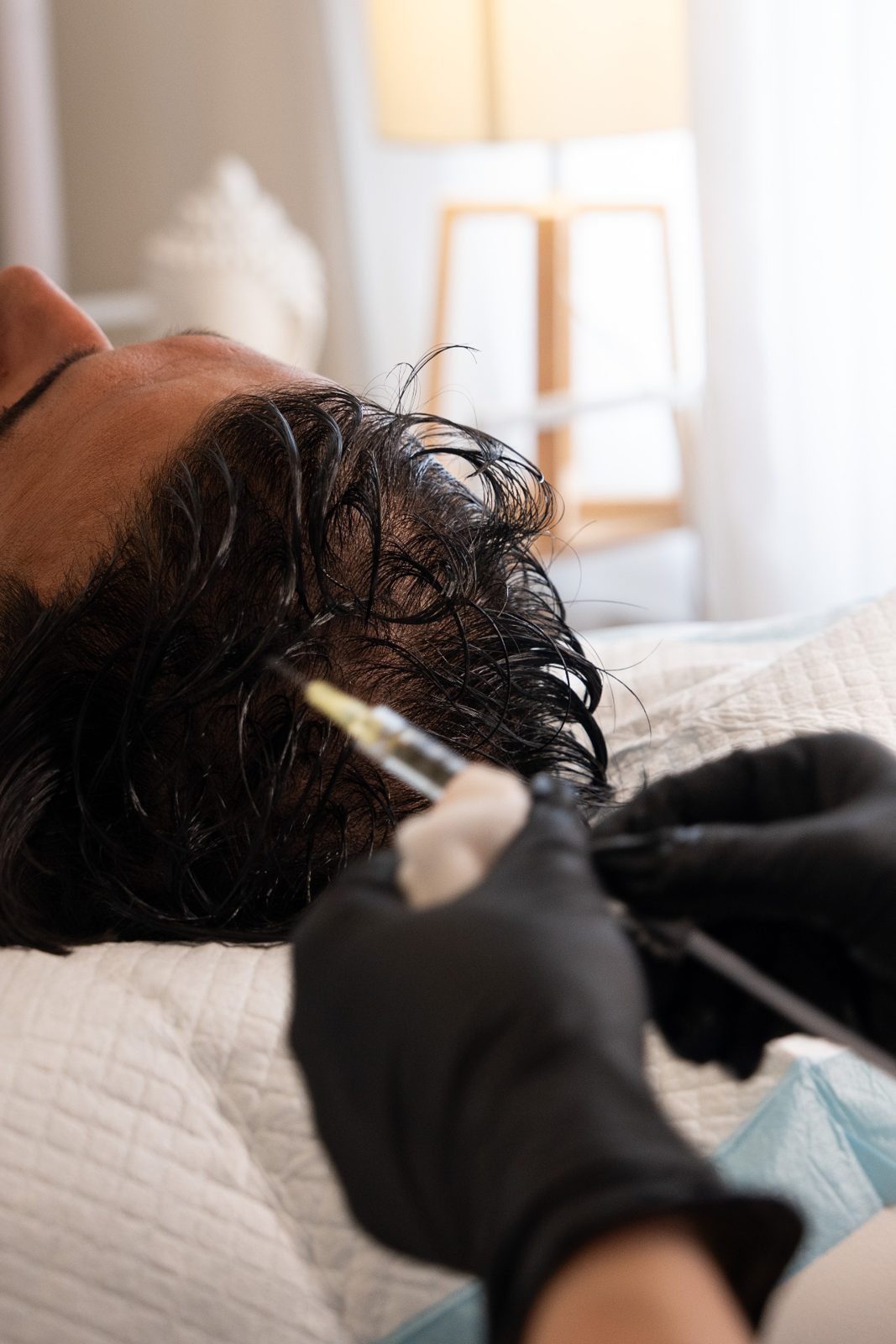 Scalp consultation at Kaiz