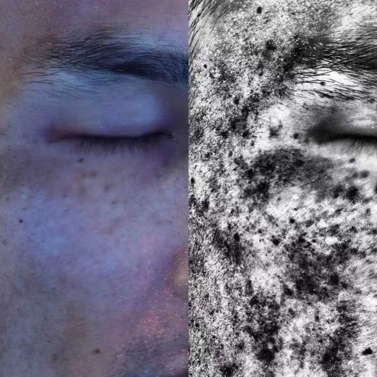 Spectrum Skin Test Kaiz Wellness Medispa | Advanced Aesthetics, Parnell Auckland