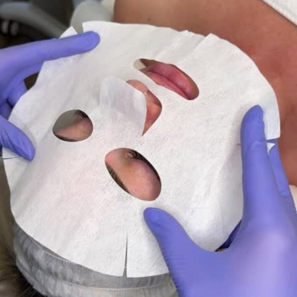Carboxy Lift Treatment