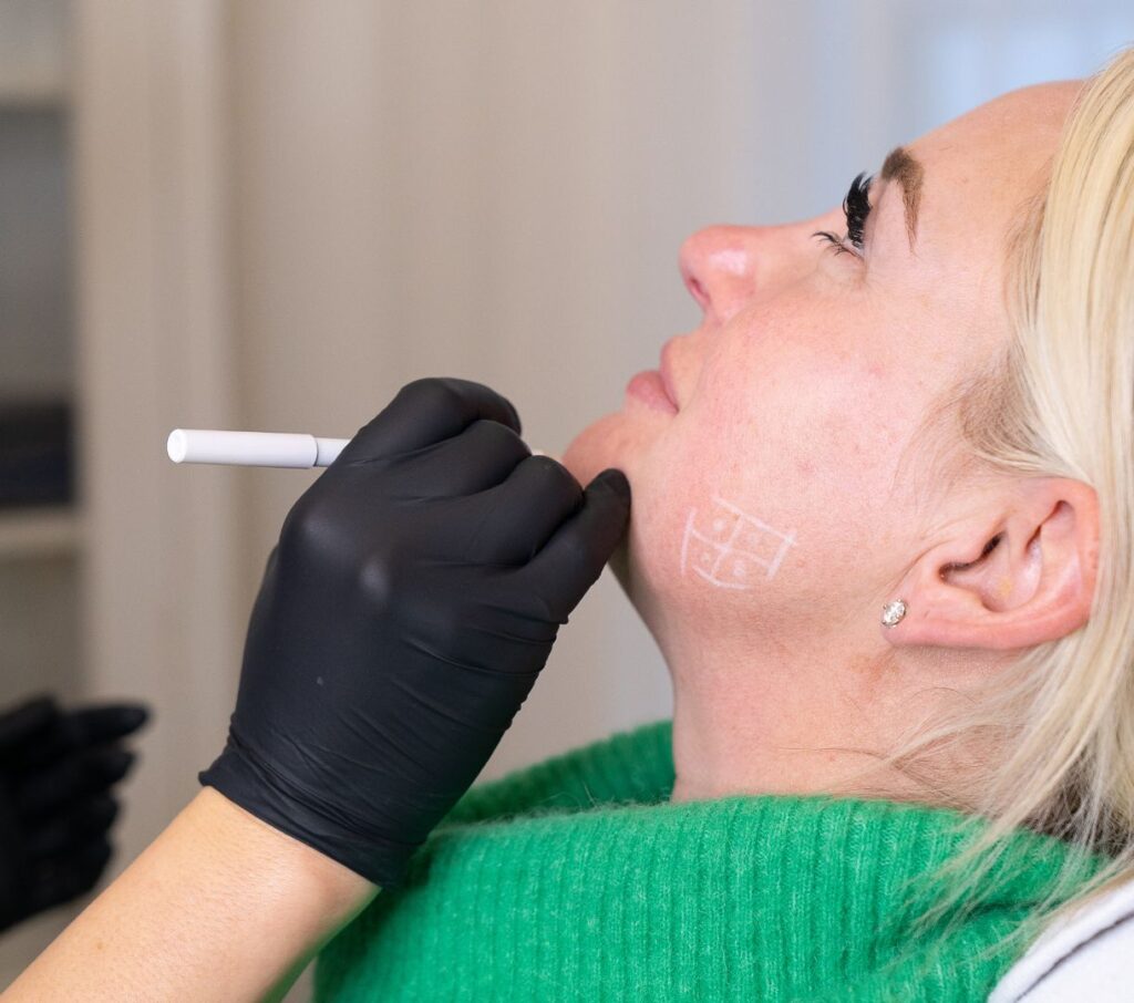 Dermal / Lip Fillers