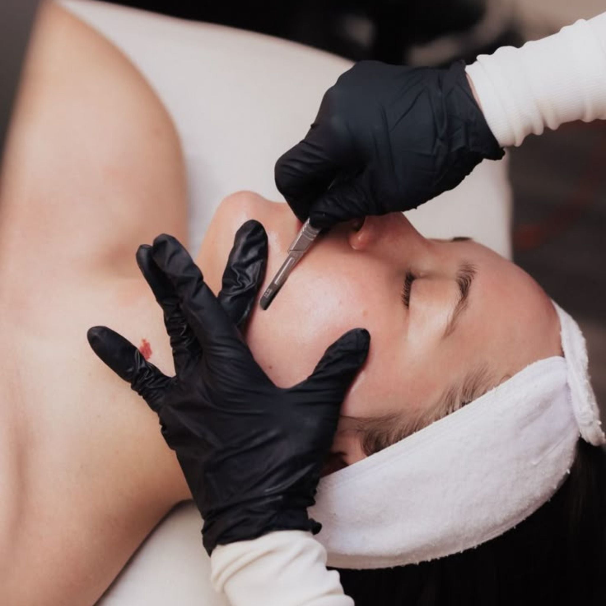 Dermaplaning Facial