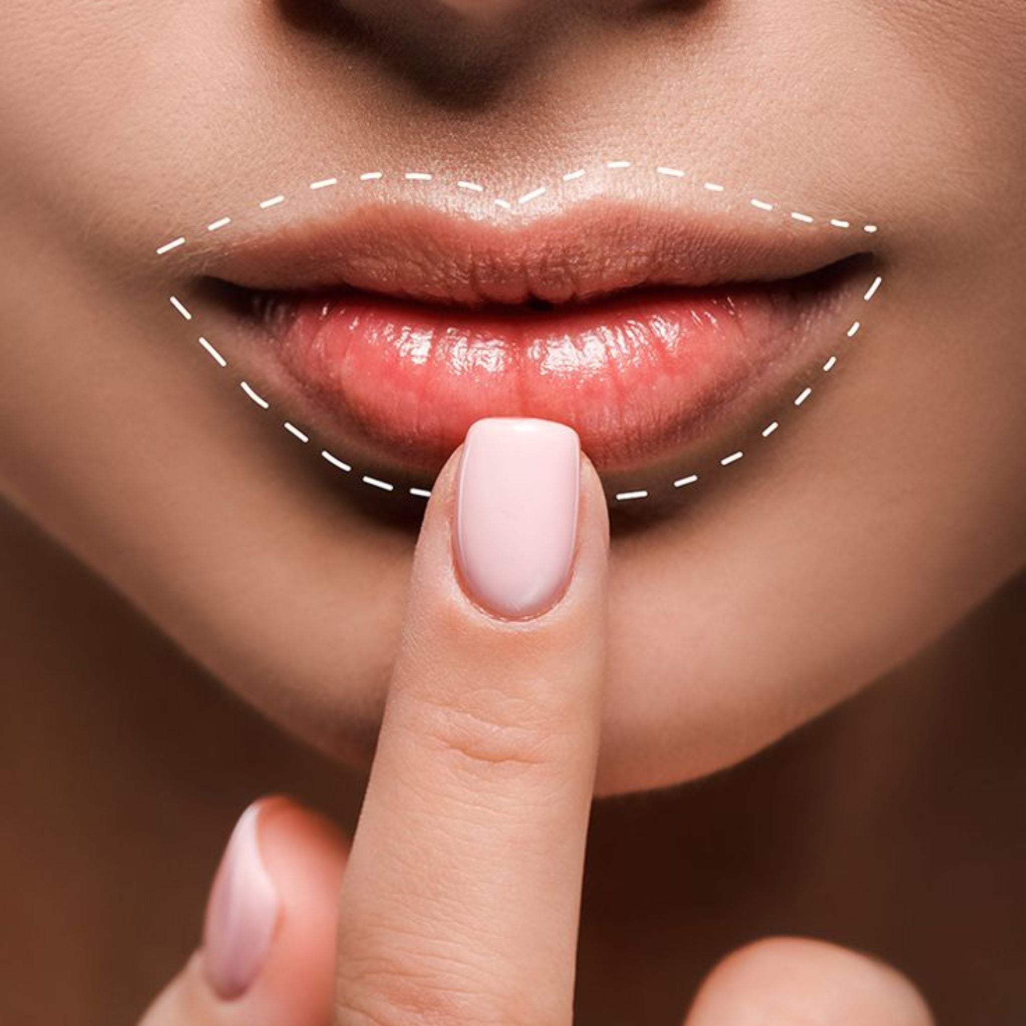 Dermal / Lip Fillers