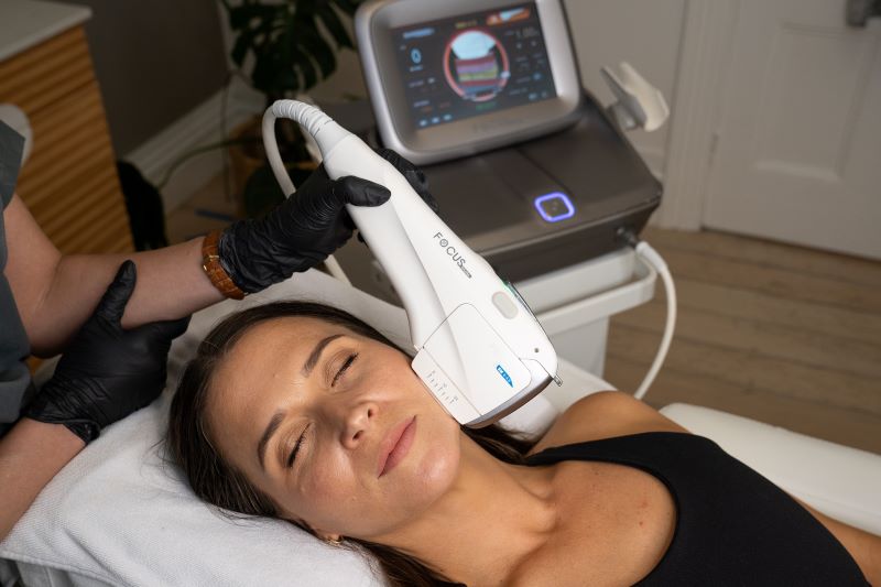 HIFU Non-Surgical Facelift