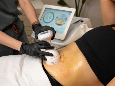 Ulfit® HIFU Body Contouring