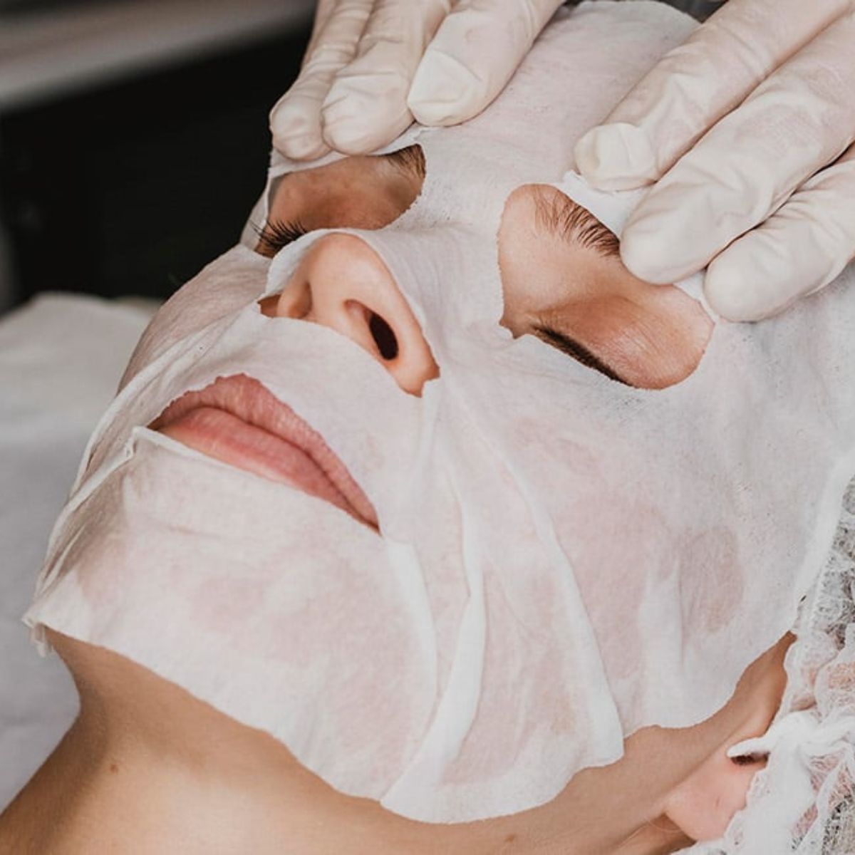 Carboxy Lift Treatment