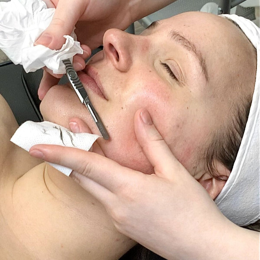 Dermaplaning Facial