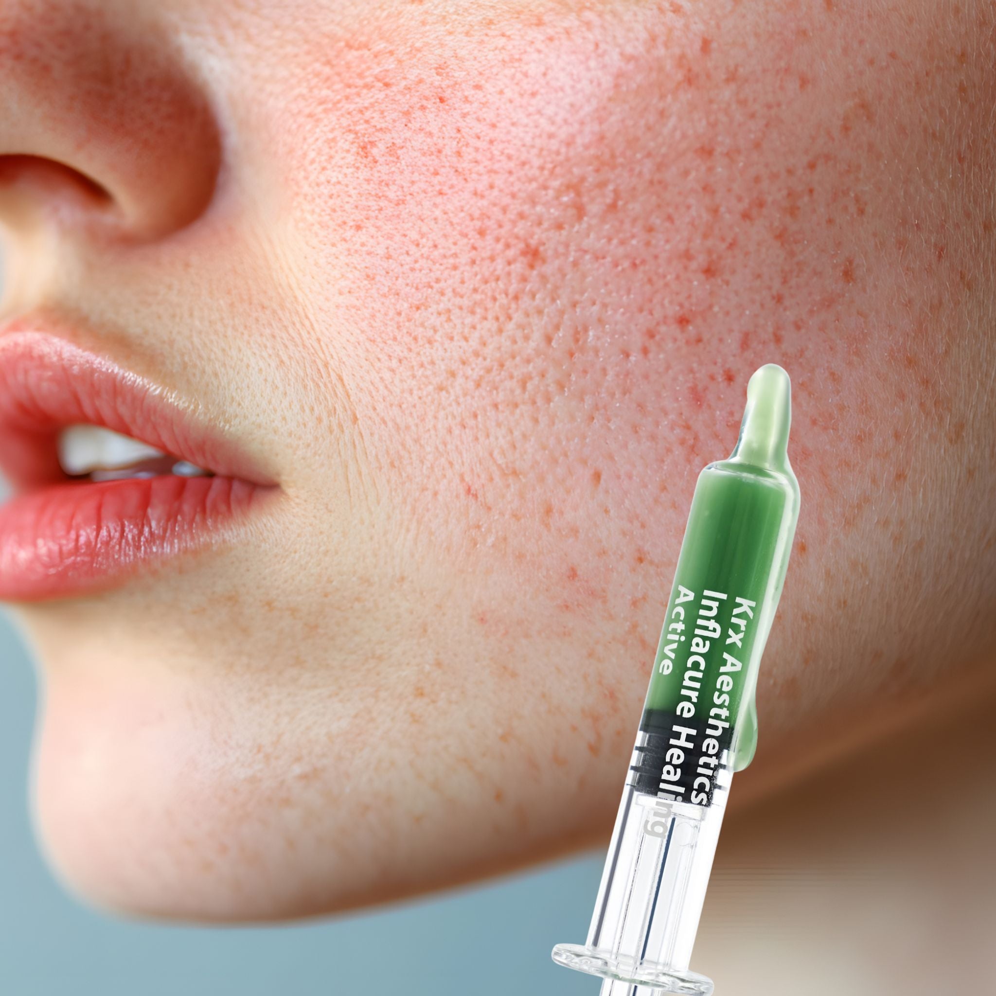 Inflacure (Rosacea/Sensitive Skin)