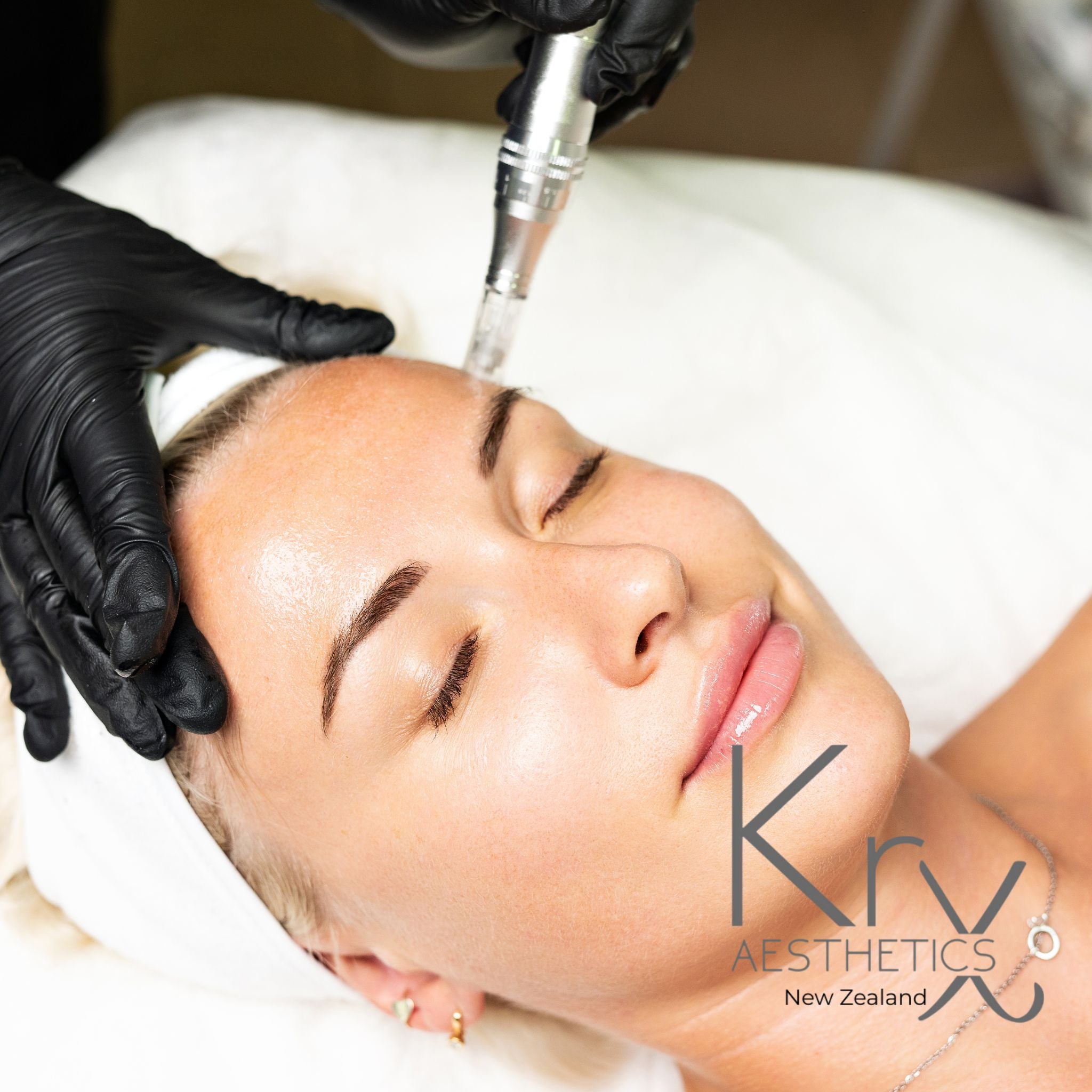 Microneedling (with KRX Serum)