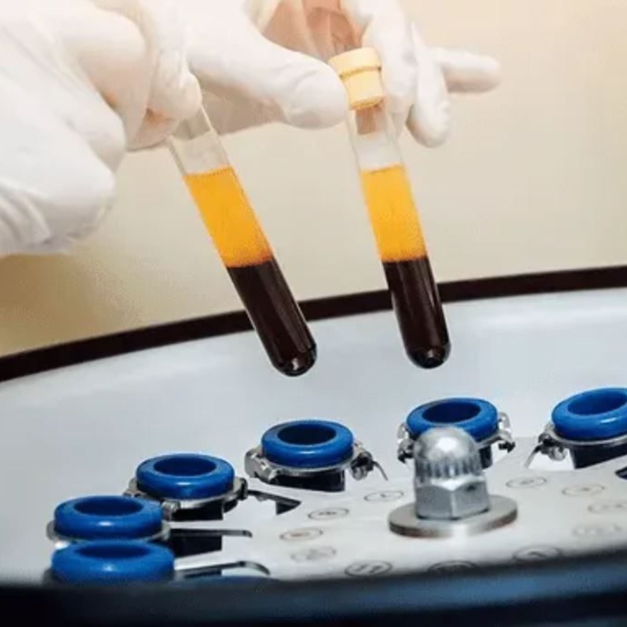 Concentrated Growth Factor (CGF)