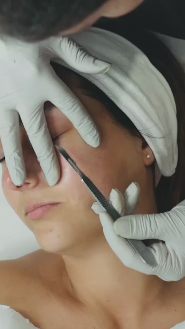 Dermaplaning Facial