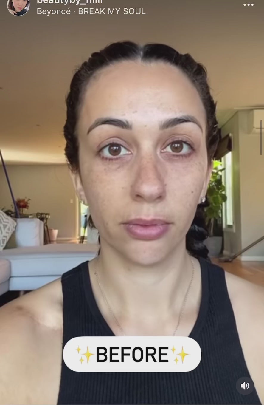 Cosmelan® Peel