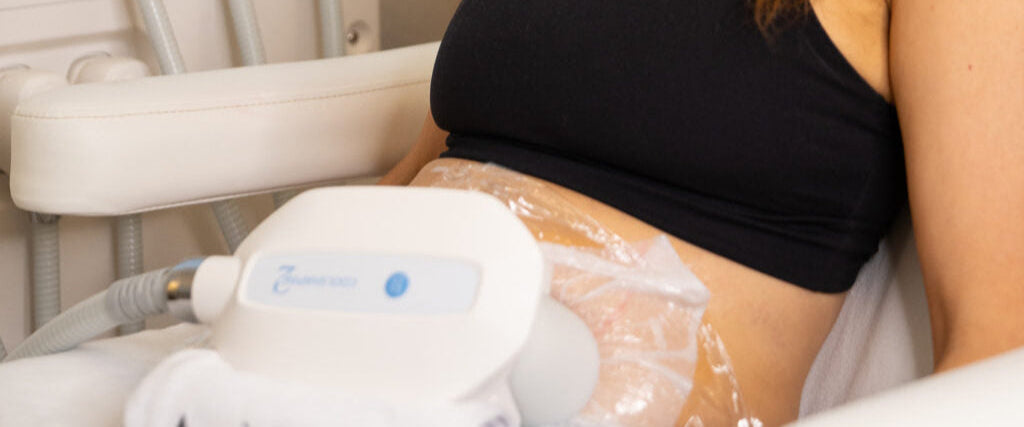 Fat Freezing